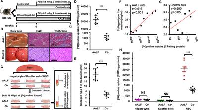 Cis-4-[18F]fluoro-L-proline PET/CT molecular imaging quantifying liver collagenogenesis: No existing fibrotic deposition in experimental advanced-stage alcoholic liver fibrosis